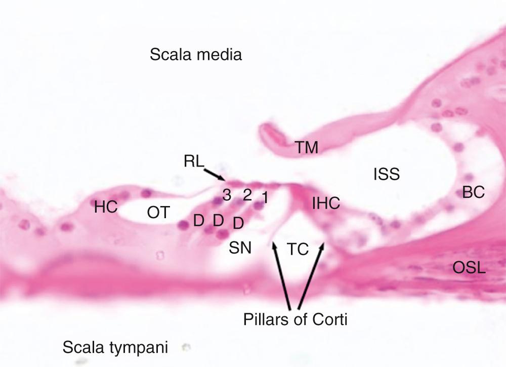 Fig. 127.2, Histologic cross section of the organ of Corti showing the major cellular structures and spaces. Note the cells: 1–3 , Three rows of outer hair cells; BC , Border cells of Held; D , Deiters cells; IHC , inner hair cell; HC , Hensen cells. Between cells are fluid-filled spaces: ISS , inner spiral sulcus; OT , outer tunnel; SN , Nuel space; TC , tunnel of Corti. These spaces are defined by structural elements: OSL , osseous spiral lamina; RL , reticular lamina; TM , tectorial membrane; pillars of Corti.