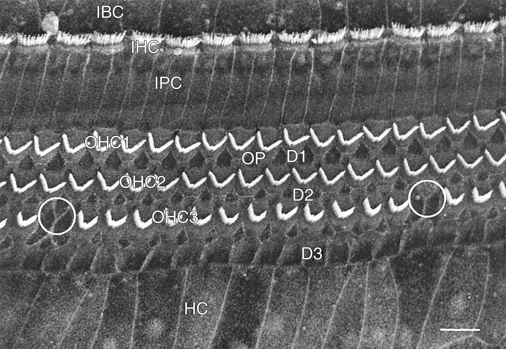 Fig. 127.4, Scanning electron micrograph shows reticular lamina of organ of Corti. Note inner border cell (IBC) and inner hair cell (IHC) locations and those of the inner pillar head plate (IPC) , three rows of outer hair cells ( OHC1 through OHC3 ), three rows of Deiters cell phalangeal processes ( D1 through D3 ), outer pillar cell phalangeal process (OP) , and Hensen cells (HC) . Two phalangeal scars (circled) are present in row three, which indicates loss of two outer hair cells. Bar = 10 µm.