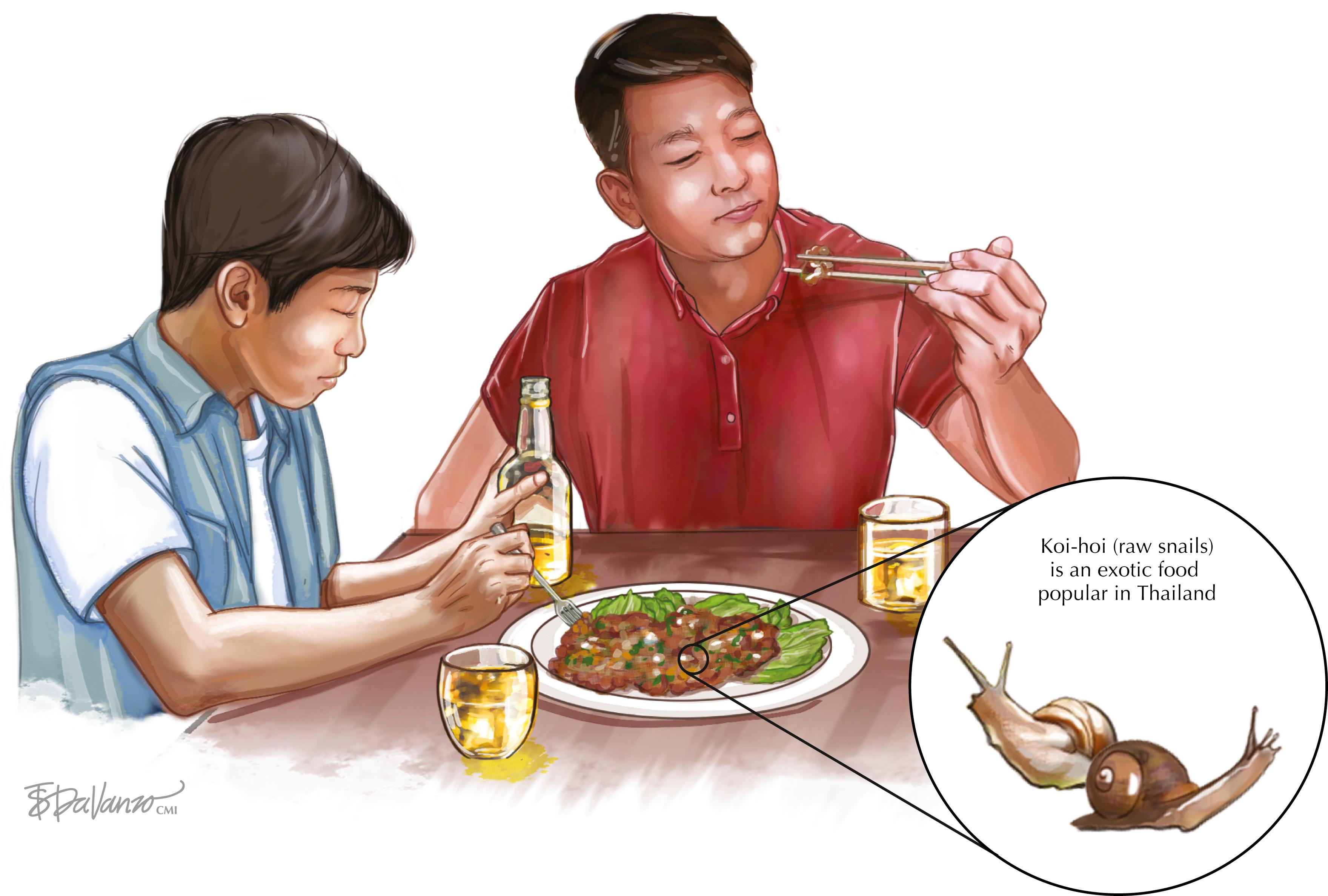 Fig. 93.2, Etiology includes eating raw or undercooked intermediate or transport hosts in exotic foods such as “koi-hoi” (snails).