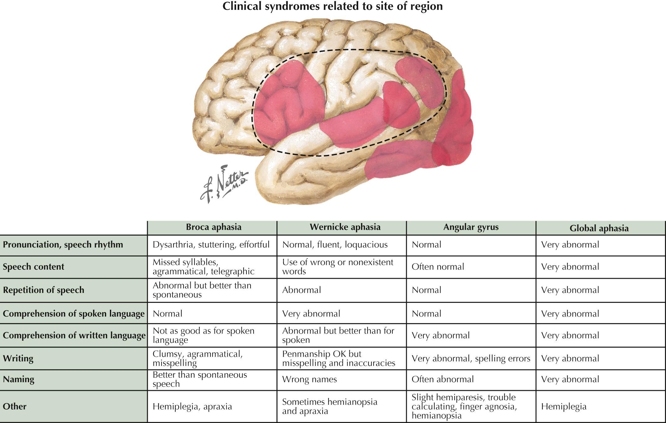 Fig. 25.3, Dominant Hemisphere Language Dysfunction.