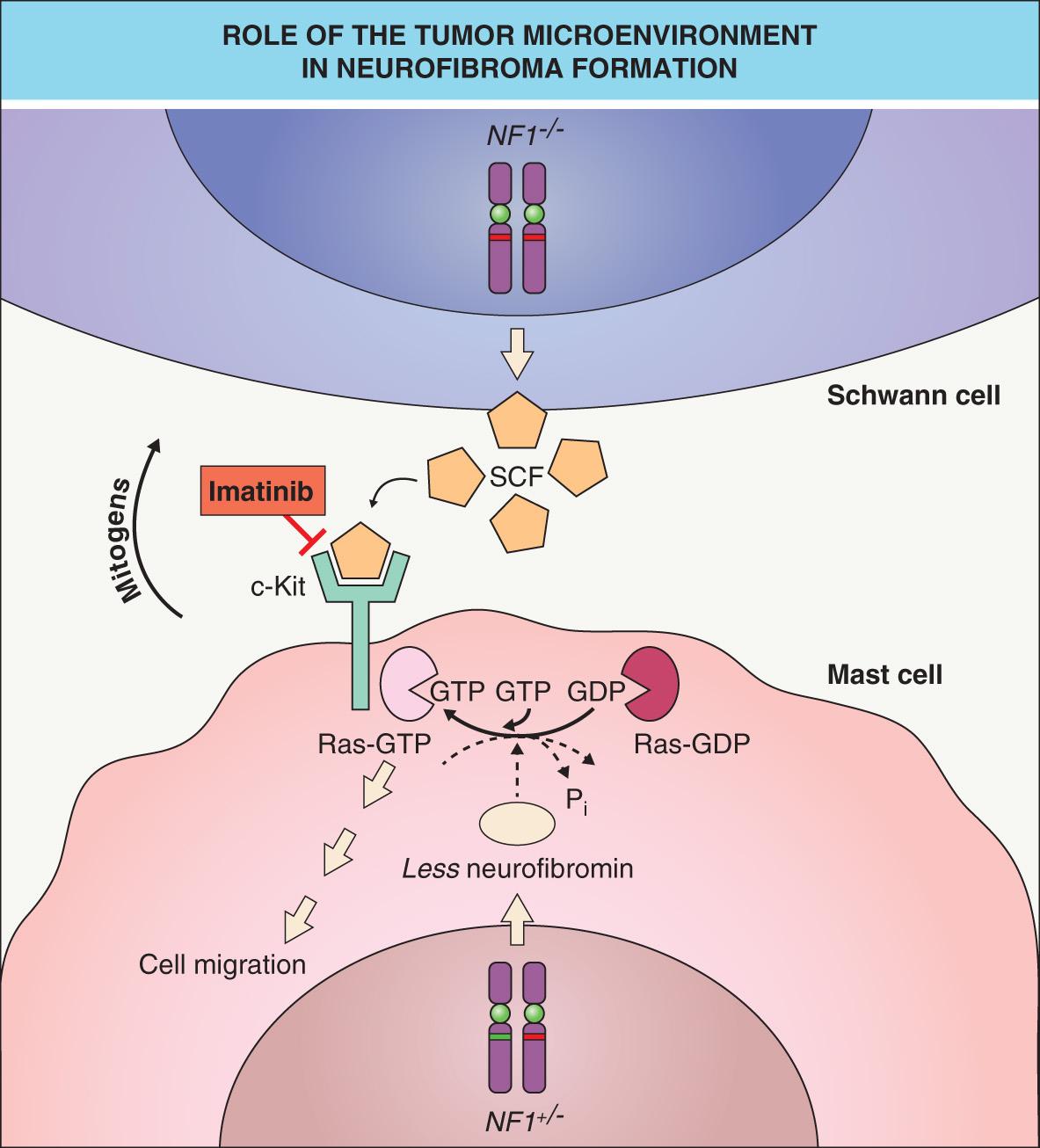 Fig. 61.2, Role of the tumor microenvironment in neurofibroma formation.