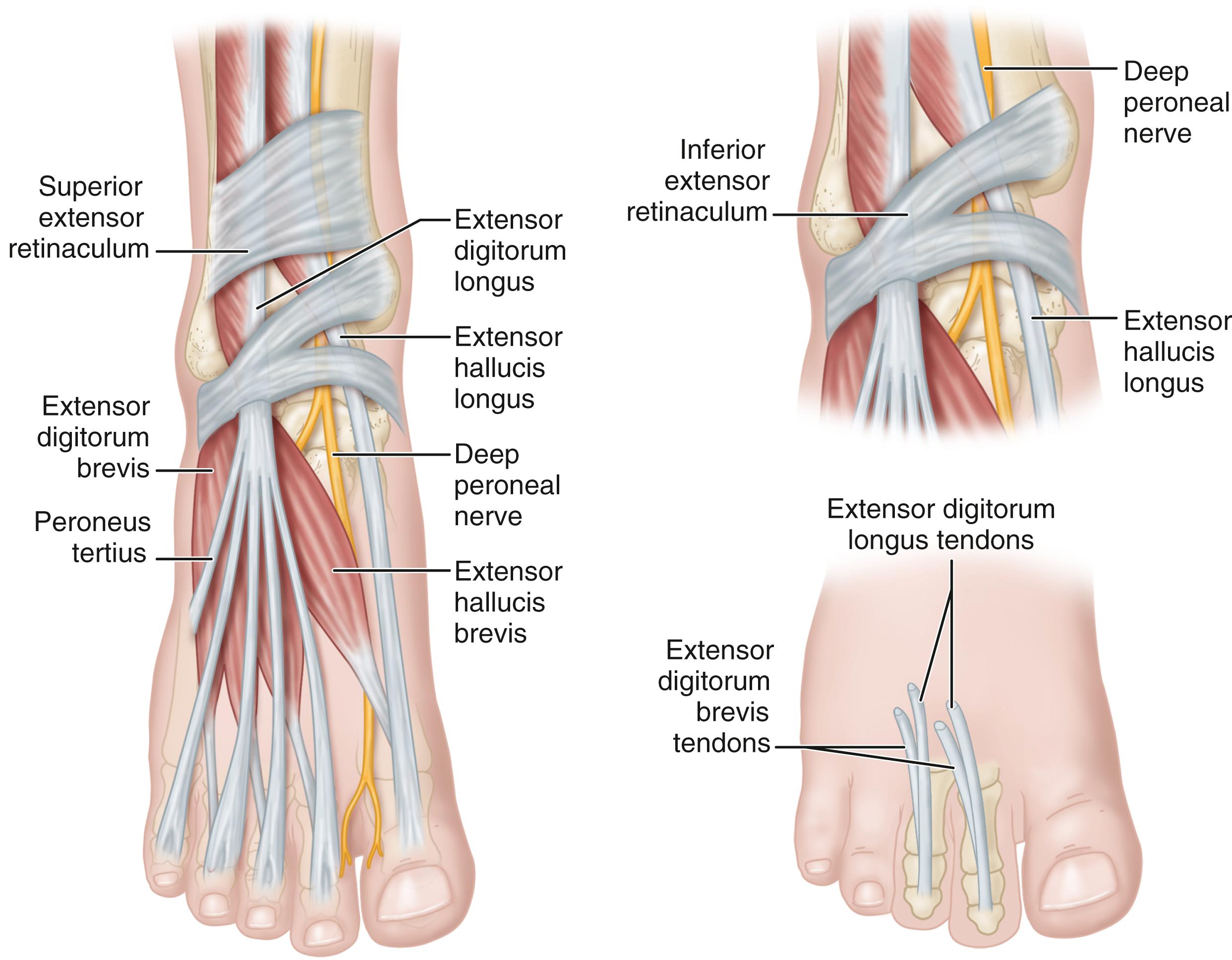 FIGURE 87.4, Anatomy of anterior tarsal tunnel syndrome.