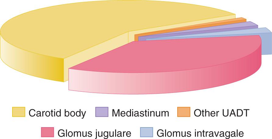 Figure 14.7, Distribution of paragangliomas of the head and neck region. UADT, Upper aerodigestive tract.