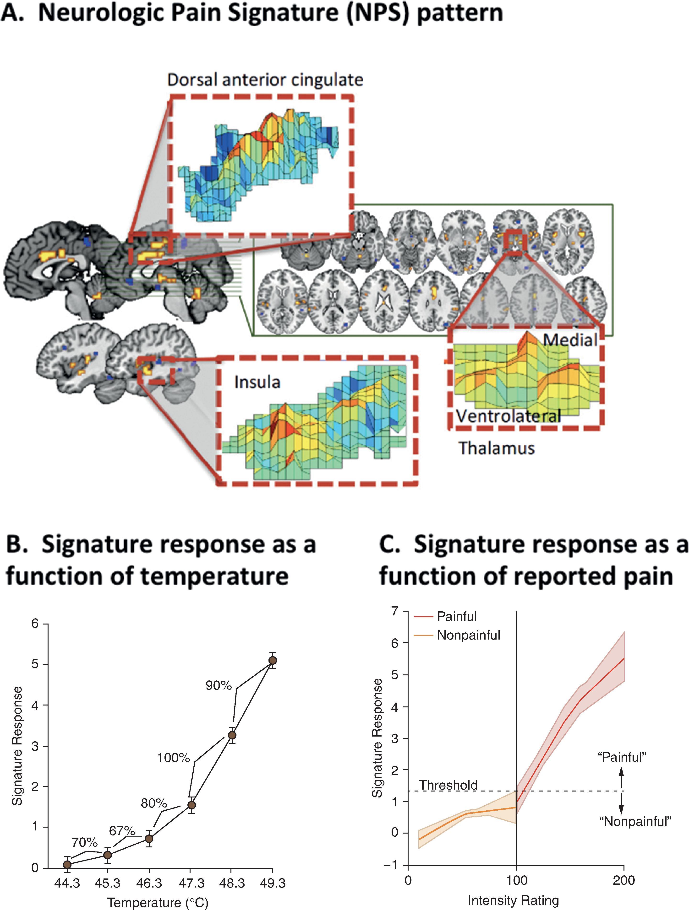 Figure 10.2, Neurologic Pain Signature (NPS). A, The NPS pattern. The map shows weights that exceed a threshold (false discovery rate of q<0.05) for the display. Insets stress the importance of multivariate patterns in the three key regions. Adapted from Zaki et al. (2016). 172 B and C, In a separate study, the NPS signature response score tracked the temperature of the stimulation (percentages represent discrimination accuracies between pairs of adjacent temperature levels), as well as subjectively reported pain (100 = pain threshold). Adapted from Wager et al. 27