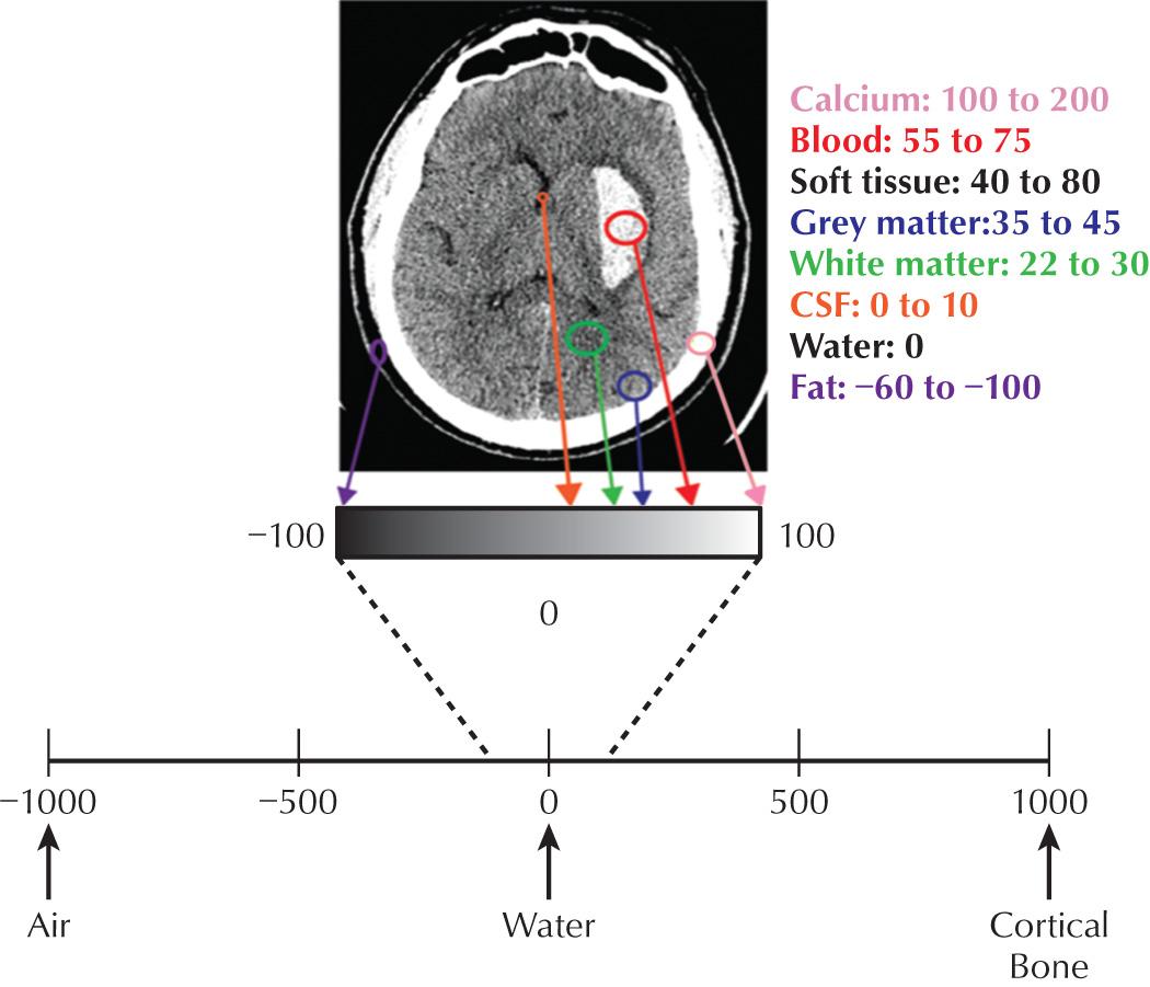 Fig. 3.1, Hounsfield Units (HU) and Brain Imaging.