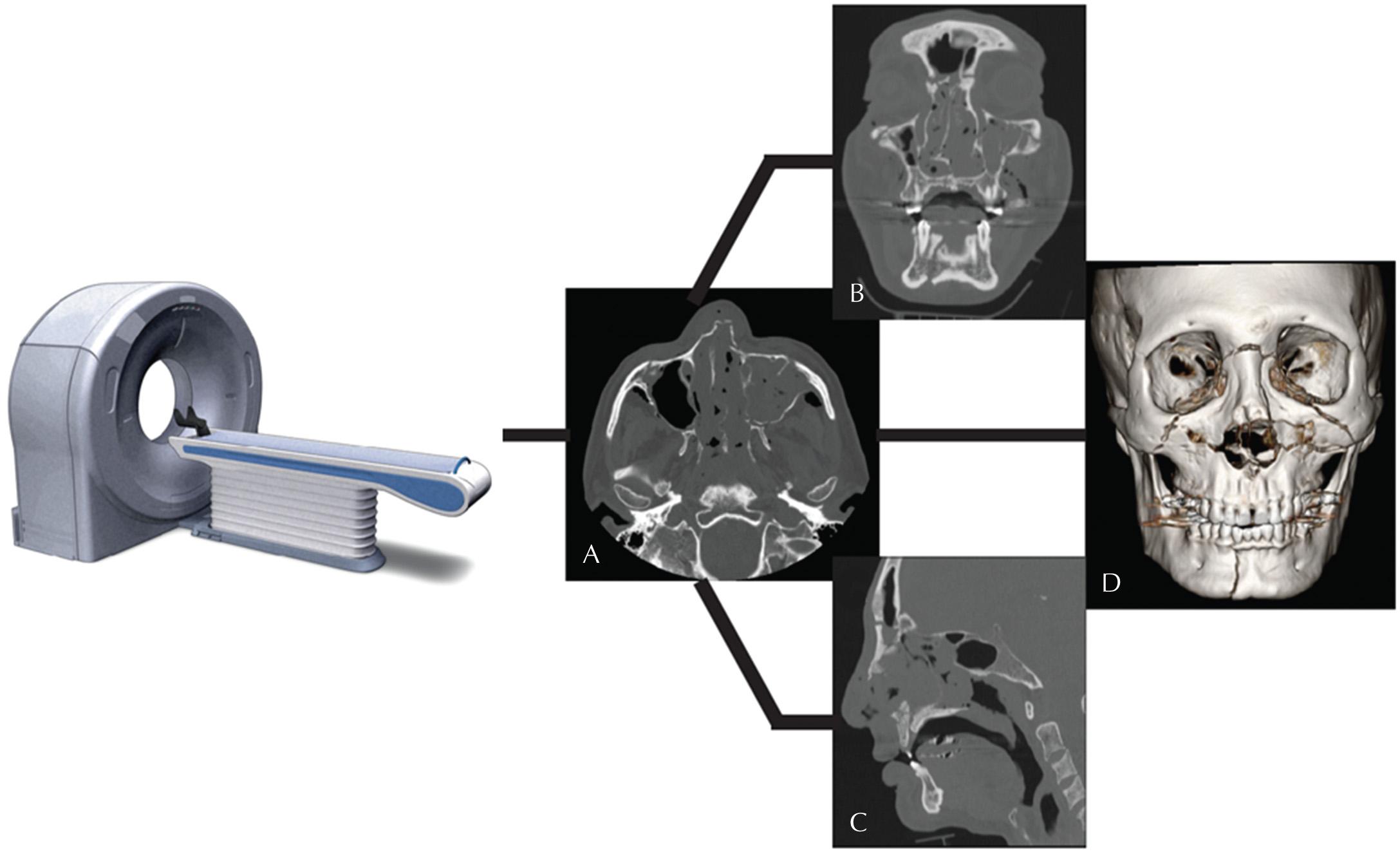 Fig. 3.5, Computed Tomography Postprocessing.