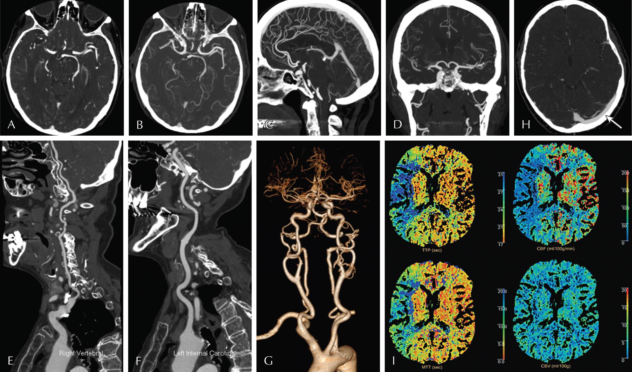 Fig. 3.6, Computed Tomography Angiography (CTA), Computed Tomography Venography (CTV), and Computed Tomography Perfusion (CTP).