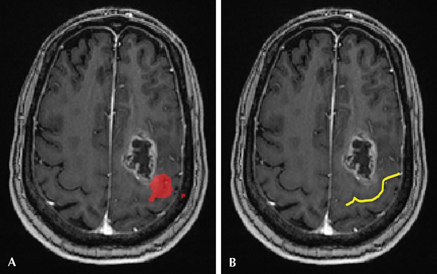 Fig. 3.10, Functional Magnetic Resonance Imaging (MRI).