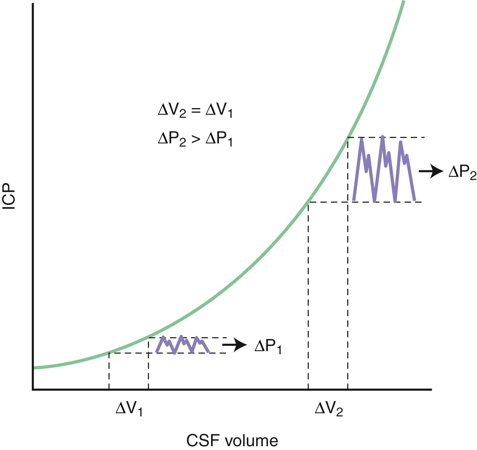 Fig. 53.2, Relationship Between Pressure and Volume Changes in the Intracranial Compartment.