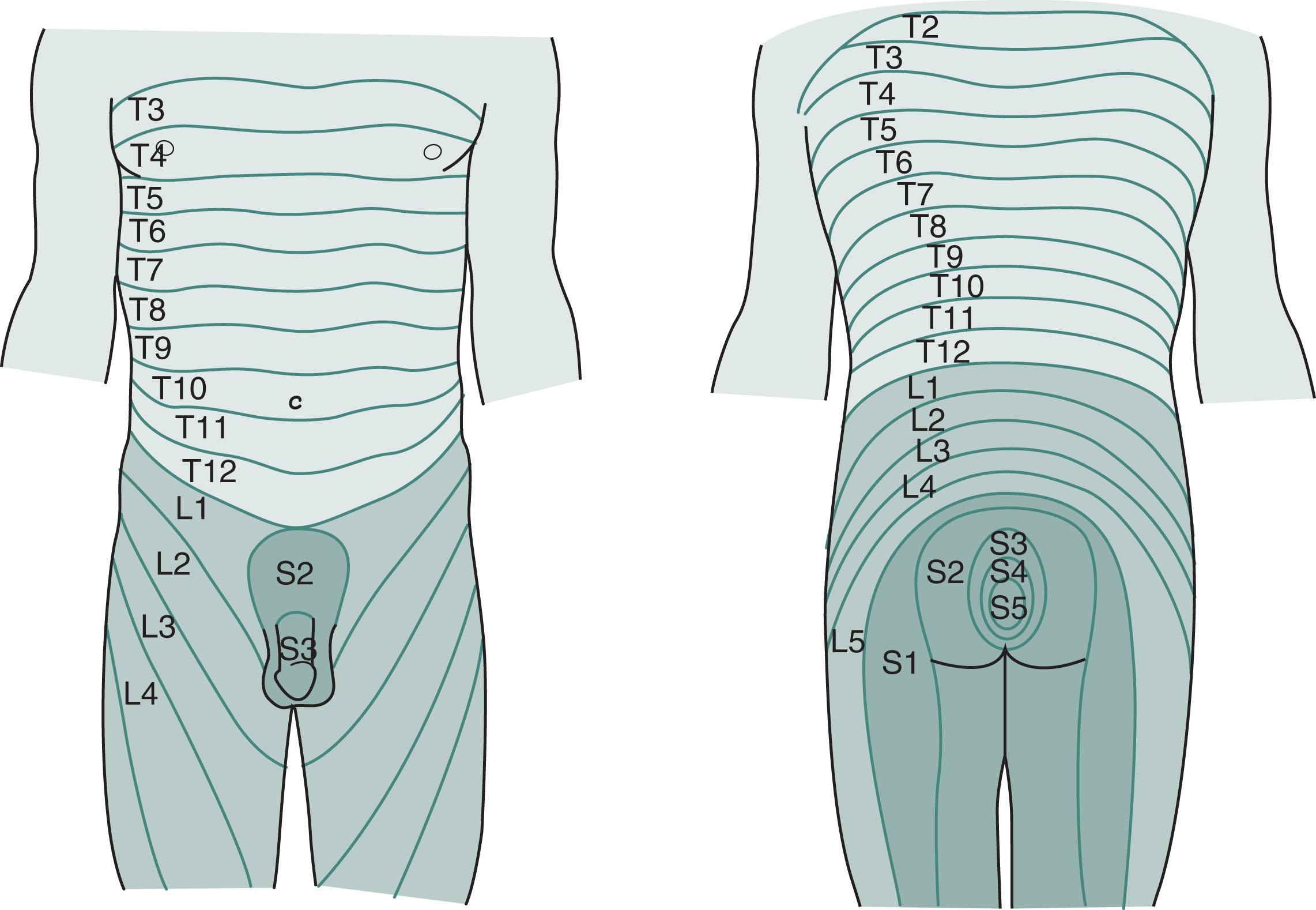 Fig. 16.2, The sacral dermatomes (S2-S5) innervate the skin overlying the genitals and anus, but the lumbar dermatomes innervate the legs.