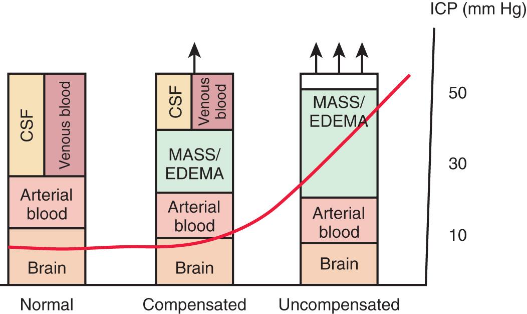 Fig. 85.1, The Munro-Kellie doctrine describes intracranial dynamics in the setting of an expanding mass lesion (i.e., hemorrhage, tumor) or brain edema.