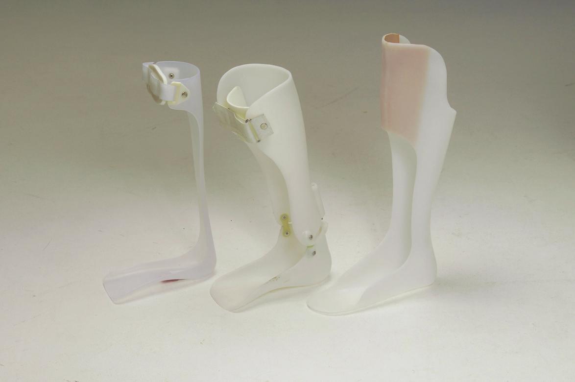 Fig. 55.2, These fabricated ankle-foot orthoses are designed for ankle and knee control in a hemiparetic patient. The narrowest one on the left can assist foot drop due to a peripheral neuropathy. A wider lateral flange with hook-and-loop straps across the front of the ankle, like the orthotic at the far right, provides greater ankle and knee control. The thermoplastic hinged ankle orthotic in the middle includes a heel stop to allow about 5 degrees of dorsiflexion for standing up and in the early stance phase of gait.