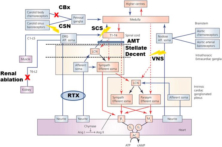 Figure 129.1, Network interactions and hierarchical organization for autonomic control of the heart. The intrinsic cardiac nervous system (ICNS) possesses sympathetic (Sympath) and parasympathetic (Parasym) efferent postganglionic neurons, local circuit neurons (LCN), and afferent neurons. Extracardiac intrathoracic ganglia contain afferent neurons, LCNs, and sympathetic efferent postganglionic neurons. Neurons in intrinsic cardiac and extracardiac networks form interdependent feedback loops with central nervous system feedback loops (spinal cord, brainstem, and higher centers) to coordinate cardiac function. Primary nexus points for neuromodulation of the neural hierarchy are indicated: these include AMT , axonal modulation therapy; CBx , surgical ablation of the carotid body chemoreceptors; CSN , carotid sinus nerve stimulation; renal ablation, and selective pharmacological interruption of cardiac afferent inputs with RTX , resiniferatoxin; SCS , spinal cord stimulation; Stellate Decent , surgical decentralization of the stellate ganglia from the central nervous system; VN S, vagal nerve stimulation.