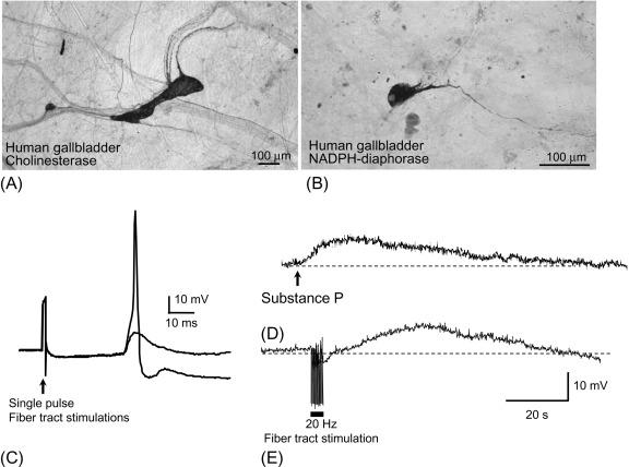 Fig. 20.1, The structure and function of gallbladder ganglia are relatively simple, as compared to ganglia of the gut. (A) Photomicrograph of two ganglia in a whole mount preparation of a human gallbladder that was histochemically stained for cholinesterase. One of the ganglia consists of a single neuron and the other contains about 12 neurons. Ganglia are interconnected by axon bundles that are contiguous with nerves that travel along blood vessels. (B) Photomicrograph of a gallbladder neuron in a whole-mount preparation of a human gallbladder that was histochemically stained for NADPH-diaphorase, which labels nitrergic neurons. Gallbladder neurons are relatively simple in structure, consisting of a single axon and a small number of short processes. (C) Synaptic responses of a guinea pig gallbladder neuron evoked by stimulation of nerves traveling along the cystic duct. All gallbladder neurons respond to cystic nerve stimulation, and these synaptic inputs are eliminated by vagotomy, indicating that all gallbladder neurons receive direct input from the central nervous system. (D, E) Brief administration of substance P and high-frequency stimulation of interganglionic fiber bundles evoke prolonged a depolarization of guinea pig gallbladder neurons. These responses, and similar responses evoked by capsaicin administration, are inhibited by application of a neurokinin 3 receptor antagonist indicating that extrinsic sensory fibers provide slow excitatory synaptic input to gallbladder neurons.