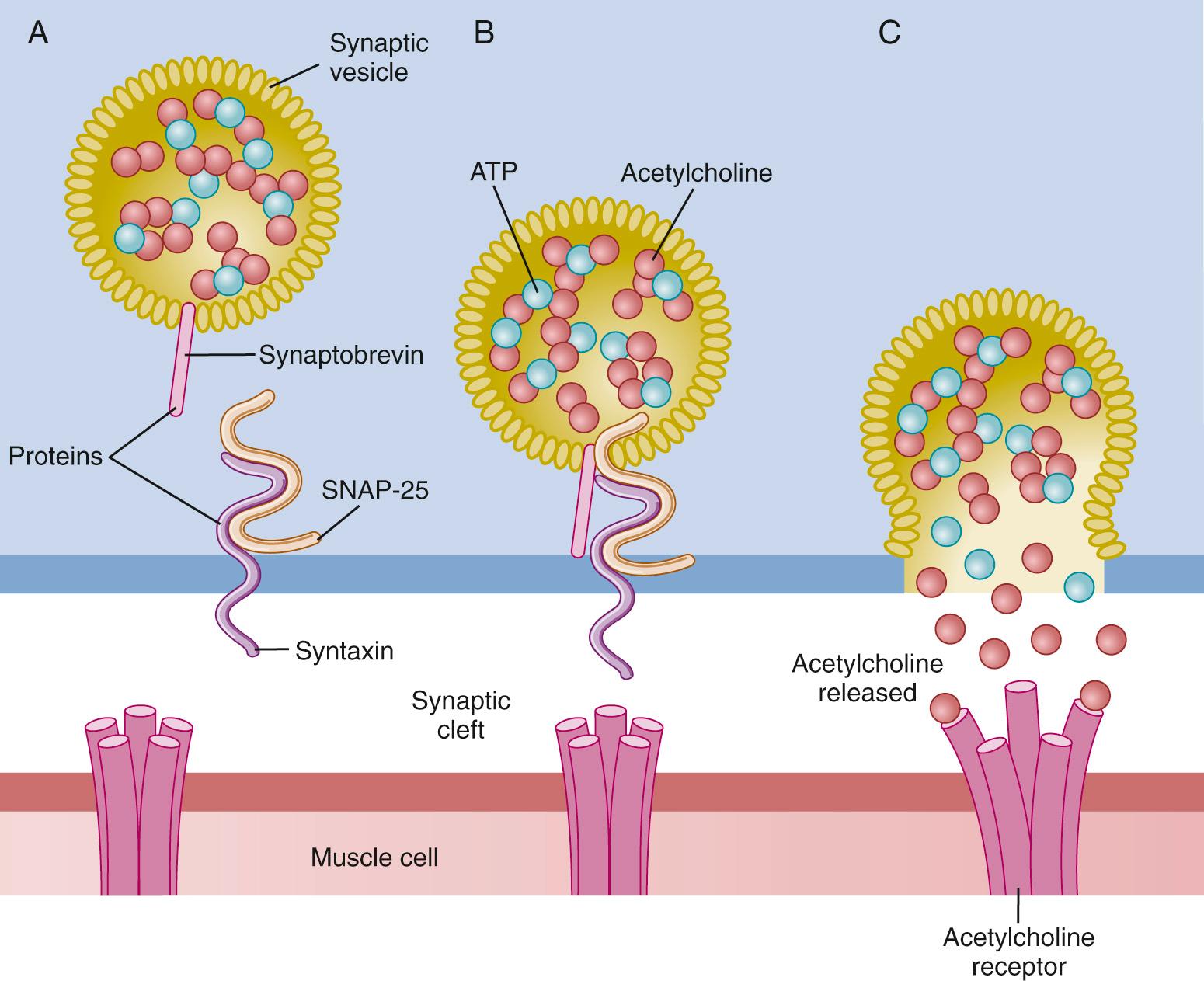 Fig. 21.2, Membrane fusion and exocytosis of acetylcholine vesicles from the motor nerve terminal. A, Acetylcholine is stored in synaptic vesicles. Its release is mediated by SNARE proteins. B, During depolarization and calcium ion (Ca 2+ ) entry through voltage-gated Ca 2+ channels, SNARE proteins on the vesicle (synaptobrevin) and on the membrane (synaptosomal-associated protein 25 [ SNAP-25 ] and syntaxin) interact and the vesicle is attached to the membrane. C, Upon depolarization and Ca 2+ entry, Ca 2+ binding to the Ca 2+ sensor synaptotagmin triggers fusion of the vesicle to the nerve membrane at the active zone to release its contents, acetylcholine. SNARE, Soluble N-ethylmaleimide-sensitive factor attachment receptor.