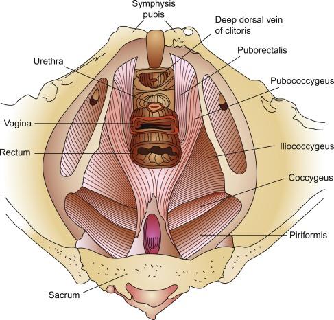Fig. 24.1, Pelvic view of the levator ani muscle demonstrating its four main components: puborectalis, pubococcygeus, iliococcygeus, and coccygeus. This assumes that the puborectalis muscle is part of the levator ani complex (see text).