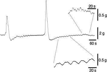 Fig. 23.3, Recording of force in a 20-mm wide strip of circular muscle from the lower sigmoid colon of a 74-year-old male. The recording was made in the presence of 1 μM tetrodotoxin to block neuronal activity and thus represents spontaneous myogenic contractility. Note three different types of contractions. Large contractions occurred regularly in this specimen at intervals of 5–8 min. Between these, contractions at approximately 3/min occurred, corresponding to the approximate frequency of slow waves generated at the submucosal border. From time to time, small bursts of more rapid contractions were visible at 12–15/min, corresponding to the frequency of myenteric potential oscilliations (MPOs) at the myenteric border.