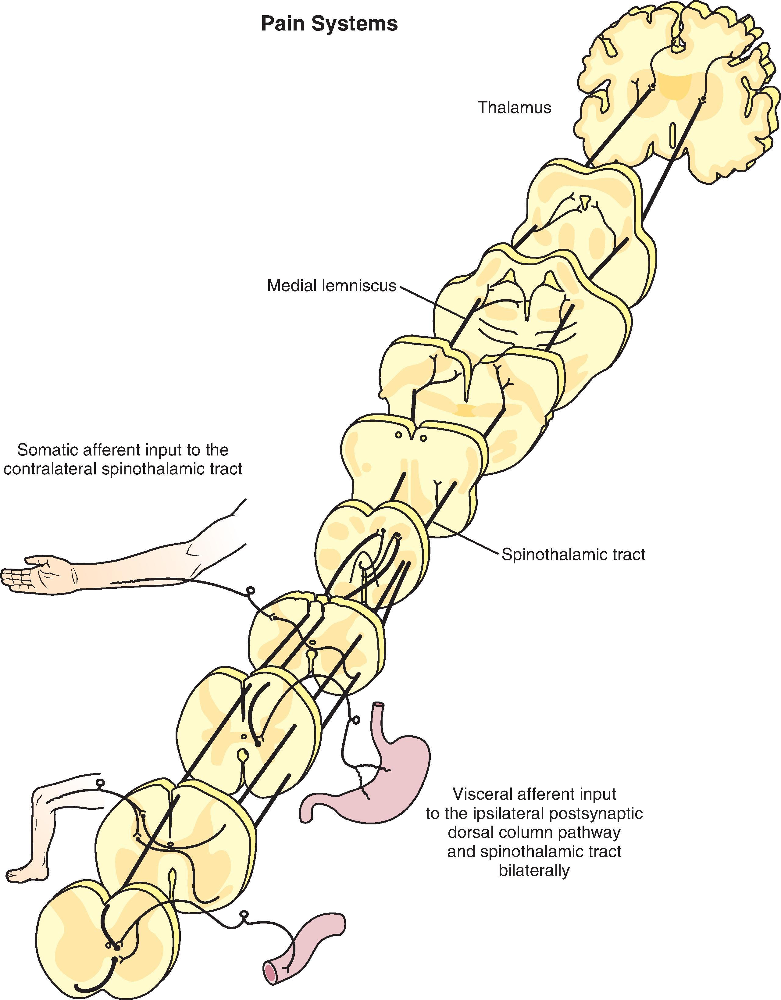 Figure 8.1, The pain systems convey input from somatic structures, as well as from viscera and other deep tissues, via peripheral nerves. Afferent nerve fibers carrying nociceptive information have free nerve endings in peripheral tissue and terminate in the superficial spinal cord dorsal horn. Information about pain is relayed through at least one synapse to cells in the spinal cord dorsal horn. Two parallel ascending pathways provide the information to integration centers in the thalamus, which provide the information to cortical regions. Input primarily from somatic structures is relayed to spinothalamic tract cells whose axons cross the midline and ascend in the lateral and ventrolateral spinal white matter as the spinothalamic tract. As the spinothalamic tract courses through the brainstem, collateral fibers innervate various brainstem centers involved in providing responses to nociceptive input on its path to the thalamus. Nociceptive input arising from visceral structures is relayed by post-synaptic dorsal column cells whose axons course in the dorsal columns. After a synaptic relay in the dorsal column nuclei and crossing to the opposite side of the brainstem, the medial lemniscus carries visceral nociceptive information to the thalamus. Both these routes are somatotopically arranged throughout their length.