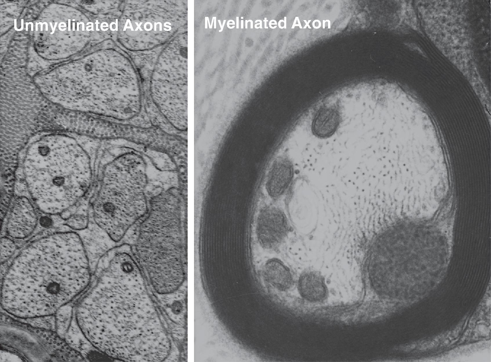 Figure 8.2, Peripheral nerves conveying information about pain are either small, slowly conducting fibers found unmyelinated in bundles or medium sized axons with thin myelin, which provides a higher conduction velocity.