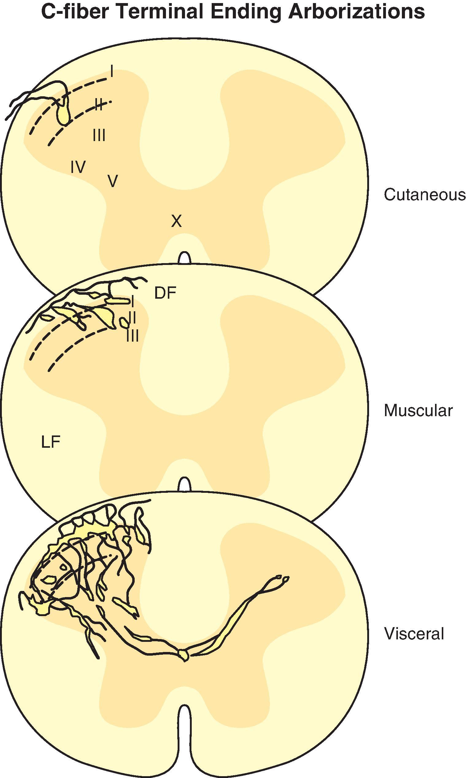 Figure 8.4, C-fiber terminal endings have been physiologically characterized and then filled with dye to reveal their terminal arborizations in the dorsal horn of the spinal cord. Examples of terminal arbors of axonal fibers with cutaneous, muscular, and visceral receptive fields are illustrated. The morphology of the cutaneous axonal ending would provide the anatomic substrate for precise point-to-point localization of a nociceptive insult on the cutaneous surface. Likewise, the diffuse widespread terminal arborization pattern of visceral afferent nerve fibers would account for the poor localization of visceral nociceptive sensation, which can be “referred” to other structures. Most visceral afferent nerve fibers innervate neurons that lie in the midline and some of the visceral fibers even cross the midline. The Roman numerals indicate Rexed’s laminae. DF , Dorsal funiculus white mater; LF , lateral funiculus white matter.