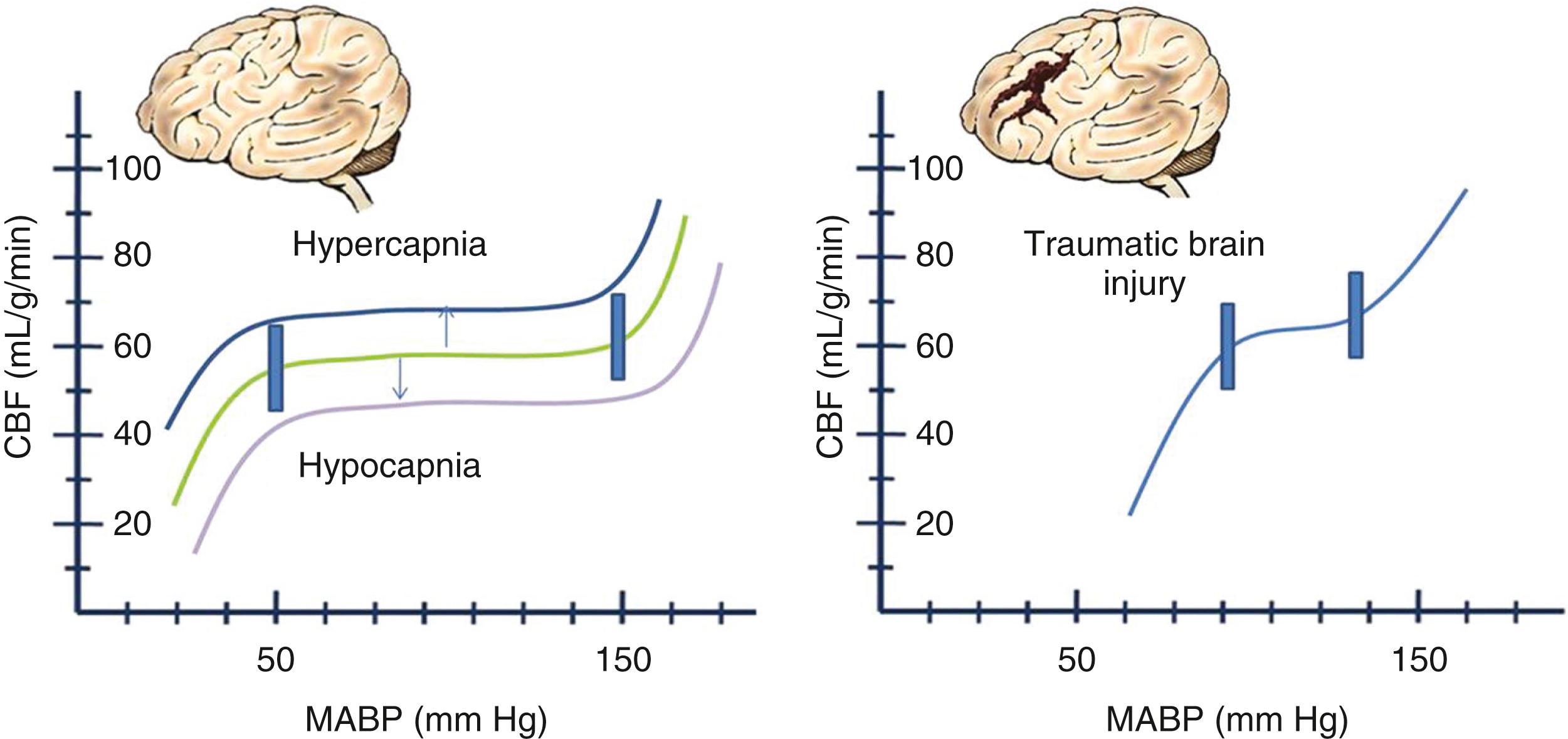 Fig. 68.1, Cerebral blood flow (CBF) as a function of mean arterial blood pressure (MABP) . Note the upward and downward shifts with hypercapnia and hypocapnia, respectively. In traumatic brain injury, the curve is steeper, with large CBF changes occurring with small pressure changes.