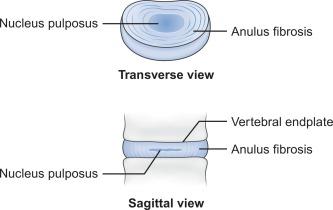 Fig. 21.4, Transverse and sagittal images of an intervertebral disk.