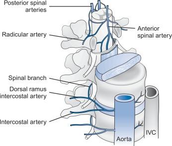 Fig. 21.8, Blood supply of the spinal cord illustrating the single anterior spinal artery, paired posterior arteries, and feeding radicular branches from the aorta. IVC, inferior vena cava.