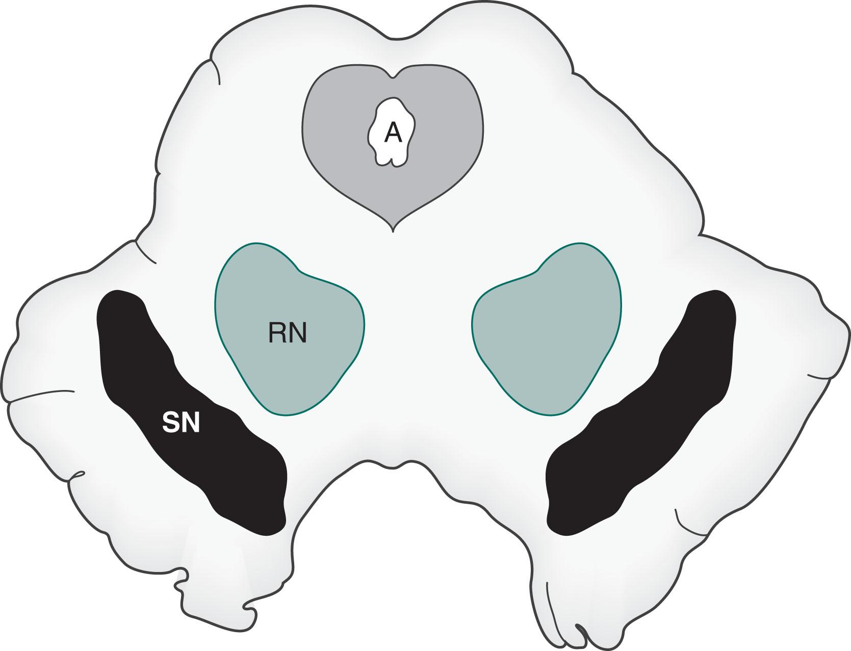 Fig. 21.1, This sketch shows a coronal view of the midbrain, which gives rise to several dopamine-producing pathways—including the nigrostriatal, mesolimbic, and mesocortical. The nigrostriatal pathway begins in the substantia nigra (SN) , the large curved black structures in the base of the midbrain (also see Fig. 18.2 ). The red nuclei (RN) , which receive cerebellar outflow tracts, sit above the substantia nigra. The upper portion of the midbrain, the tectum (Latin, roof; tego ), contains the aqueduct of Sylvius (A) surrounded by the periaqueductal gray matter.