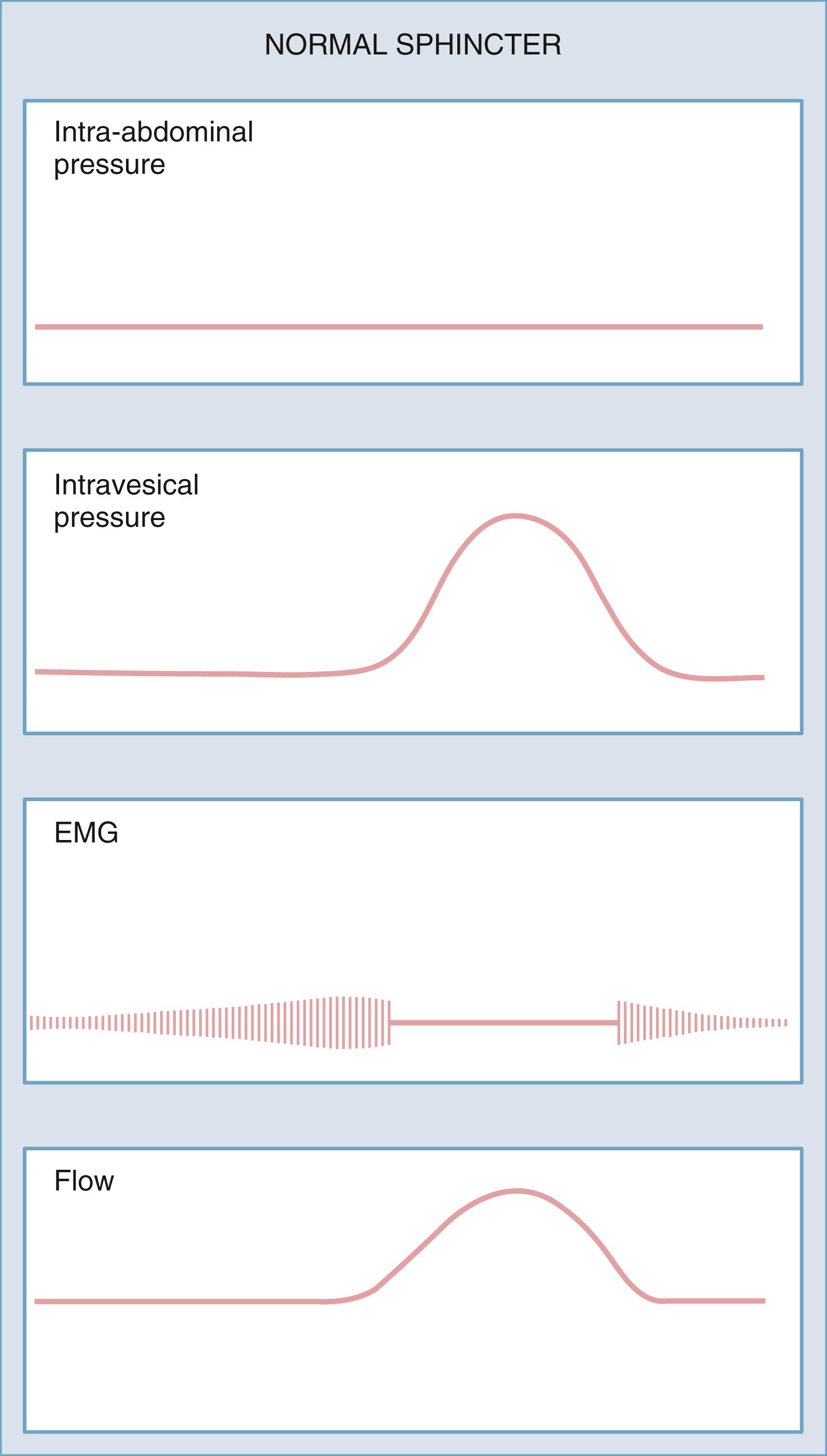 Figure 17.11, Relationship of sphincter activity to abdominal and vesical pressure during micturition. EMG, Electromyographic activity.