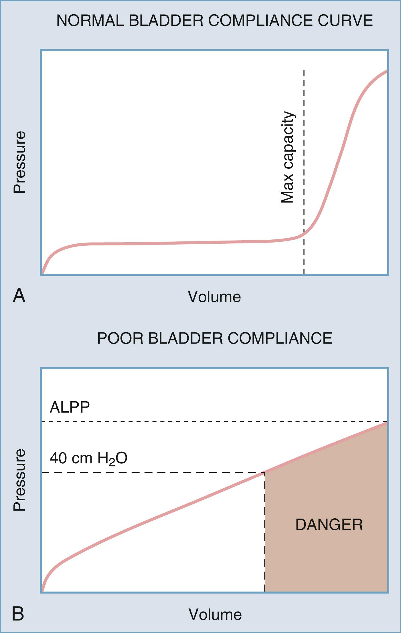 Figure 17.10, Bladder compliance curves demonstrating changes in bladder volume relative to changes in bladder pressure.