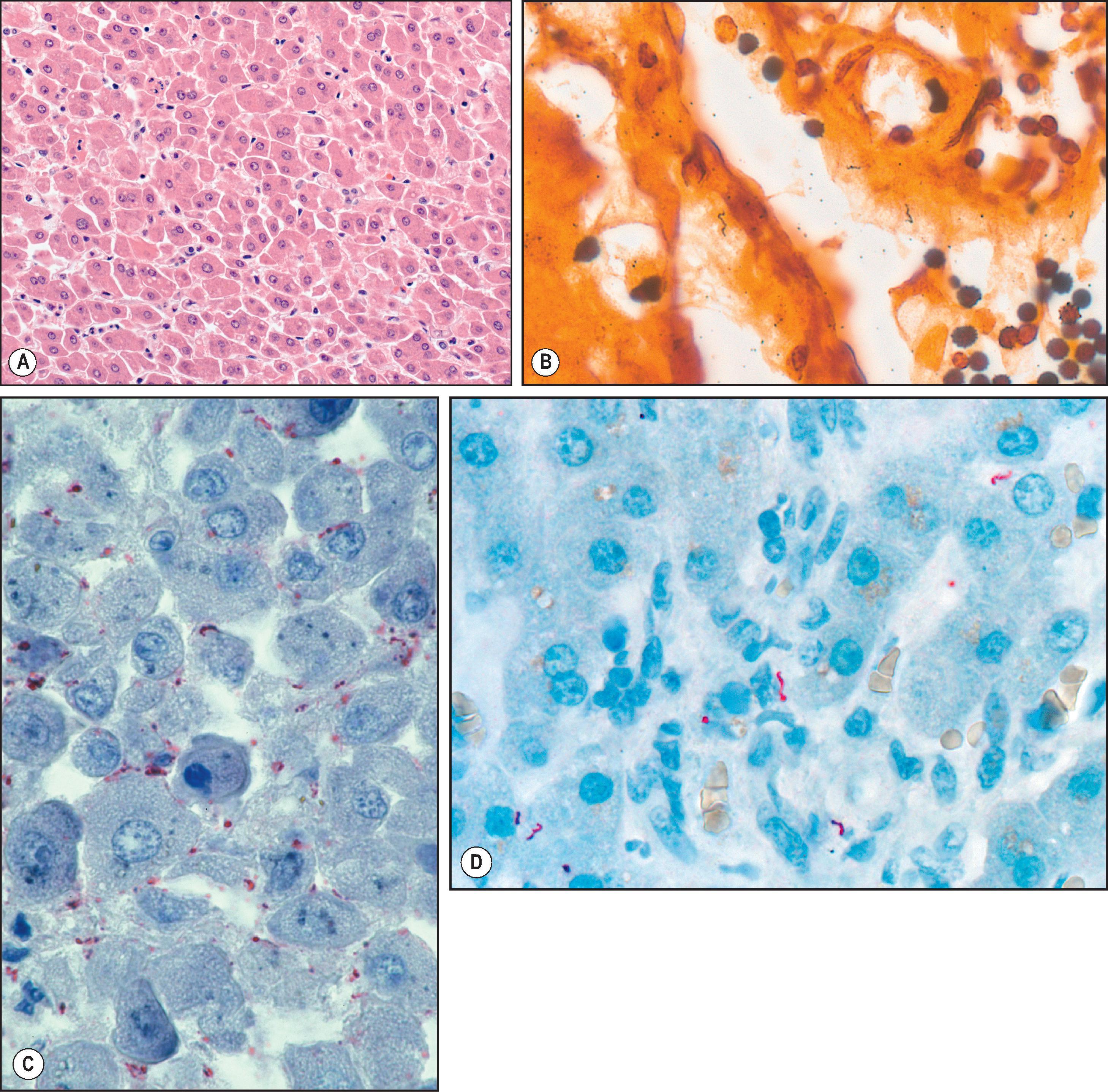 Figure 7.39, Leptospirosis. (A) Liver showing typical dissociation of hepatocytes and sparse inflammation. (H&E stain.) (B) Silver-positive leptospires are seen (arrow) (Warthin–Starry stain). (C, D) Immunohistochemical staining showing abundant granular and intact leptospires (arrow).