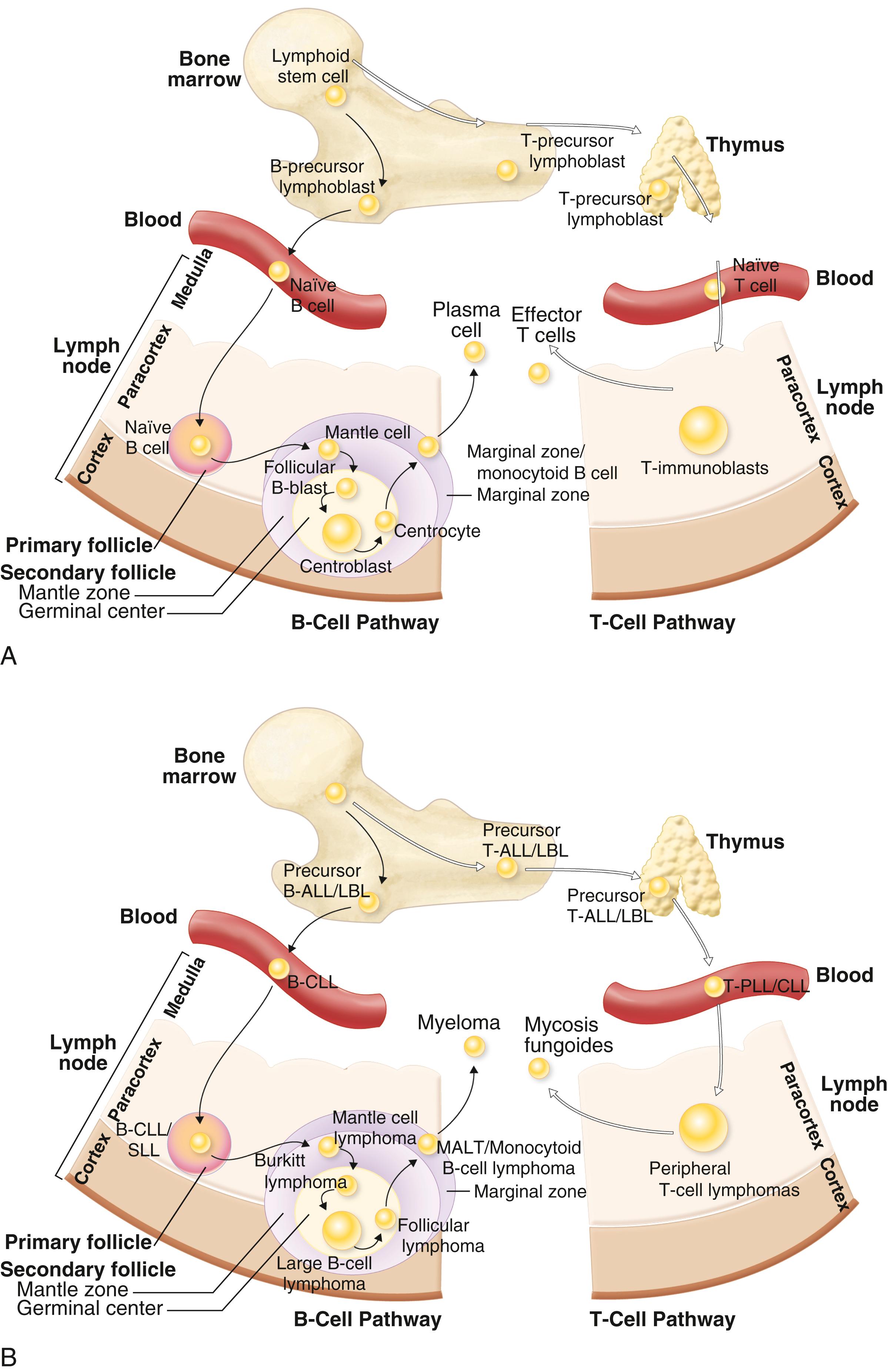 E-FIGURE 171-1, Postulated normal counterparts of currently recognized B- and T-cell malignancies.