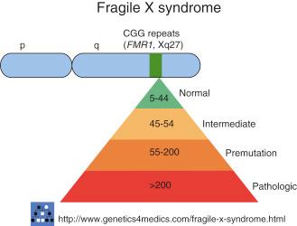 FIG. 2.1, Fragile X syndrome ( http://www.genetics4medics.com/fragile-x-sydrome.html ). Clinical significance of increasing number of CGG repeats in the fragile X mental retardation 1 (FMR1) gene. Individuals with 6–44 repeats are unaffected, those with 45–54 are in an intermediate range, 55–200 are premutation carriers, and >200 repeats is a full mutation and is associated with the syndrome.