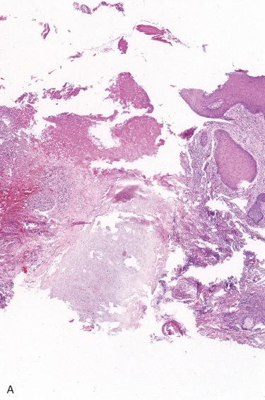 Fig. 23-10, CNCH.