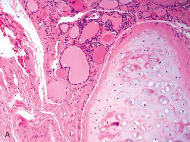 Fig. 27-31, Cartilage in the thyroid gland.