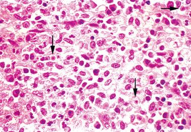 Fig. 7.40, Malacoplakia. Three Michaelis–Gutmann bodies (arrows) are present.