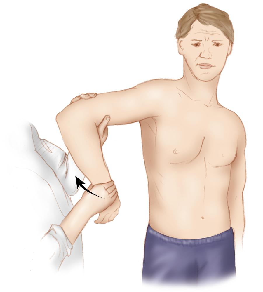 Fig. 41.2, Examination of abduction internal rotation contracture of patient, showing contracture and facial pain in internal rotation (abducted internal rotation).