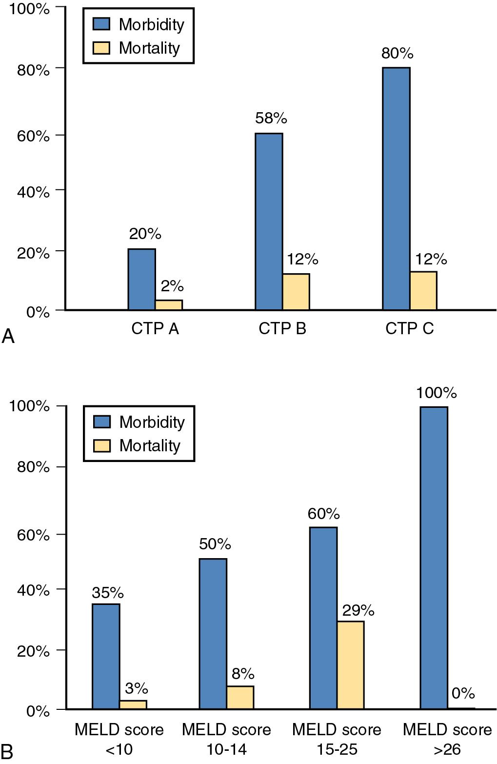 FIGURE 75.2, Perioperative morbidity and mortality rates in a recent series of patients who underwent nonhepatic abdominal surgery. A, Stratified by Child-Turcotte-Pugh (CTP) class. B, Stratified by Model for End-Stage Liver Disease (MELD) score.