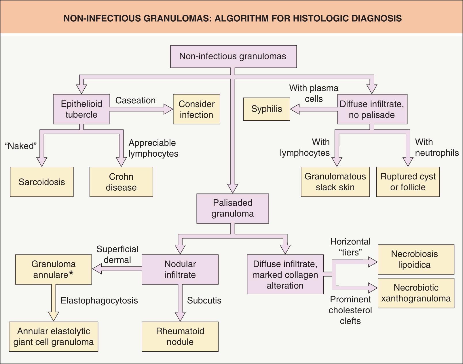 Fig. 93.1, Non-infectious granulomas: algorithm for histologic diagnosis.