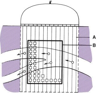 FIG 14.4, Duplex ultrasound system. A linear array transducer is used to create a matrix of sample volumes. A grayscale image is created within area A . Most examinations are performed with color-coding of velocities limited to a portion of the image (area B ). Within this portion of the matrix, ultrasound pulses from sample volumes with a change in frequency are interpreted as velocity data. Otherwise, the data are coded as part of the gray-scale image.