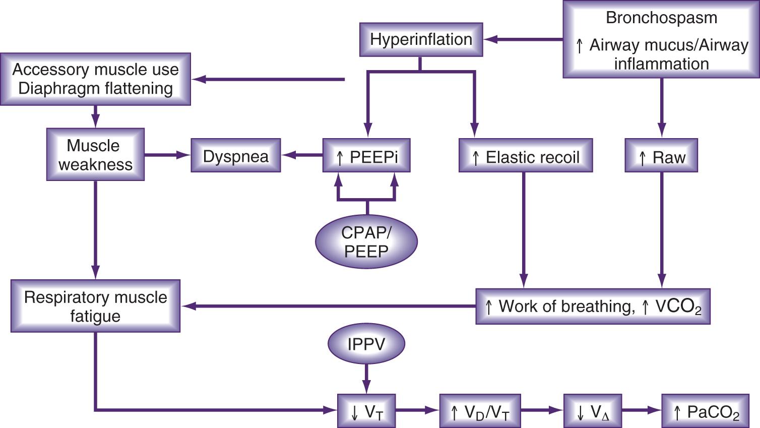 Fig. 55.2, Pathophysiology of acute hypoxemic respiratory failure and points where positive-pressure and oxygen supplementation interrupt the process. Low ventilation-perfusion ratios, shunt, and alveolar hypoventilation cause hypoxemia. Hypoxemia is treated by increasing the fraction of inspired oxygen (FiO 2 ) (limited benefit with shunt) and applying positive pressure (continuous positive airway pressure [ CPAP ] or positive end-expiratory pressure [ PEEP ]) to increase the residual functional capacity, open collapsed alveoli and narrowed airways, and enhance compliance. An additional beneficial effect of CPAP may occur in patients with cardiogenic pulmonary edema because it reduces both venous return and left ventricular afterload, which may enhance cardiovascular performance in patients with dilated, hypocontractile left ventricles. IPPV, Intermittent positive-pressure ventilation; PaCO 2 , arterial partial pressure of carbon dioxide; PPPi , intrinsic PEEP; VCO 2 , production of carbon dioxide.