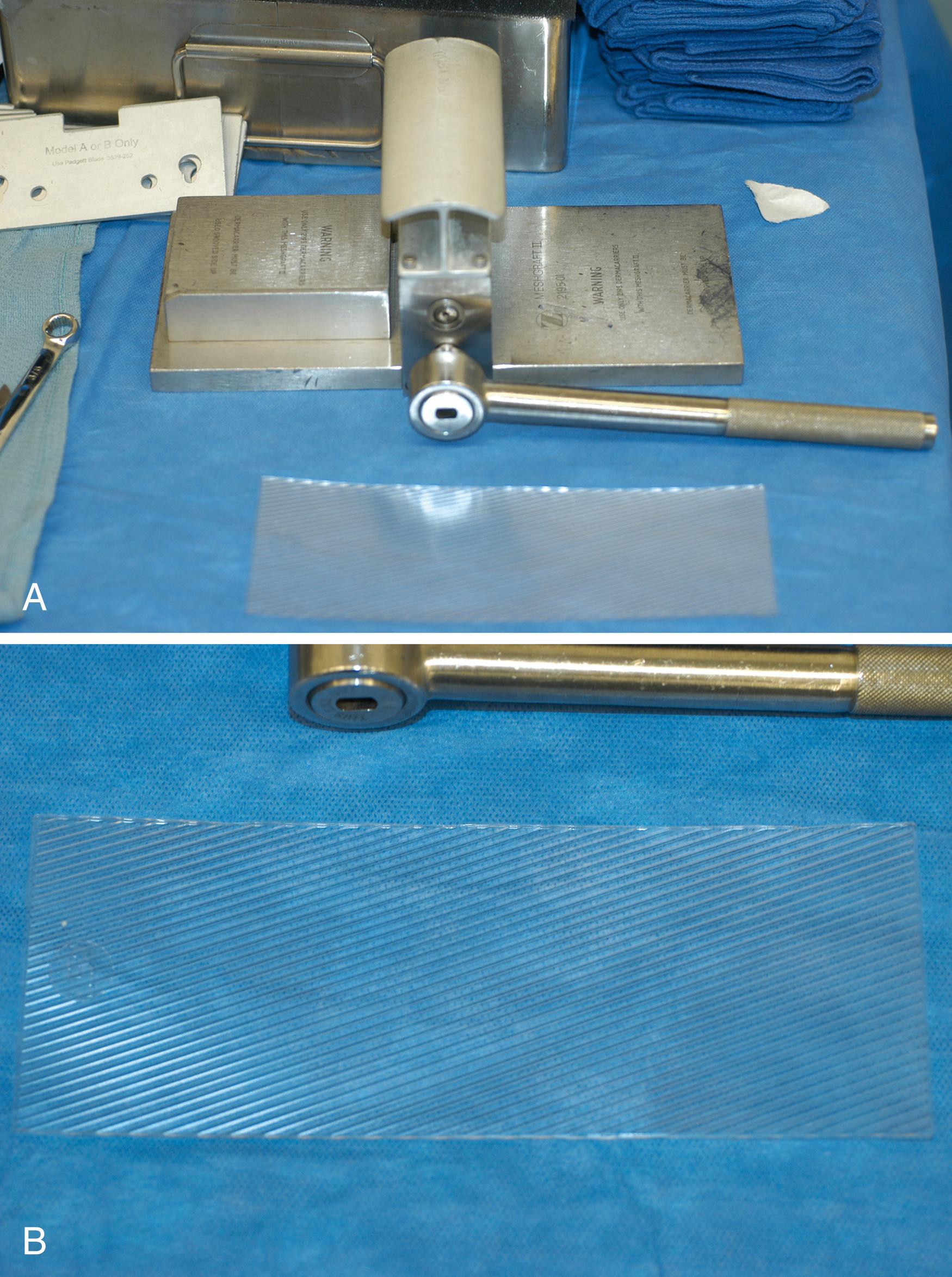 Fig. 44.7, A, The mesher device with a “dermacarrier” board in front. B, Note oblique troughs in board that control the size of mesh of graft.