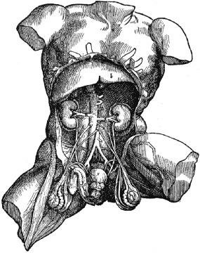 Fig. 1.1, Vesalius’s anatomic illustration of the male genitourinary tract published in 1543. Note that the left kidney is incorrectly placed lower than the right.