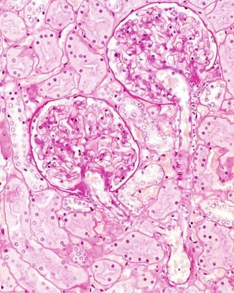 Fig. 1.23, The interlobular artery supplies arterioles to glomeruli (periodic acid–Schiff stain).