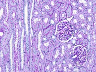 Fig. 1.25, Renal cortex sectioned perpendicular to the renal capsule that shows a medullary ray ( left side ) and the cortical labyrinth with two glomeruli ( right side ) (periodic acid–Schiff stain).