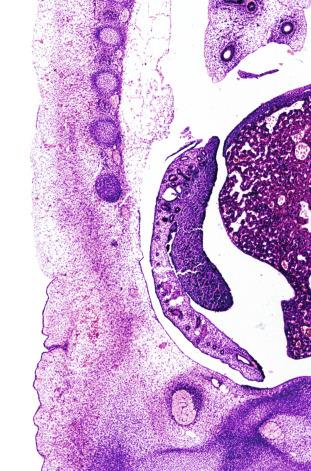 Fig. 12.1, Longitudinal section of a fetus showing the primitive gonad as an elongate structure along mesonephros. In the upper corner of the image the lung can be recognized, and the liver is in front of the gonad.