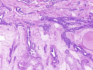 Fig. 12.119, Undescended testes of an adult.