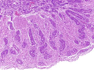 Fig. 12.12, A 16-week-old fetal testis showing numerous Leydig cells in the interstitium and slightly convoluted seminiferous tubules.