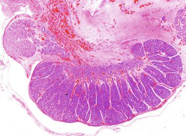 Fig. 12.16, Longitudinal section of the testis and the caput and tail of epididymis from a newborn. Intratesticular septa split the testis into lobules that converge in the mediastinum.