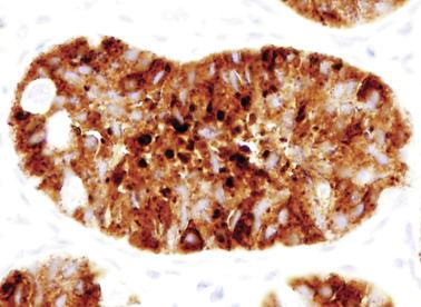 Fig. 12.19, Newborn testis.